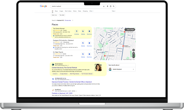 Google SEO for Dentists